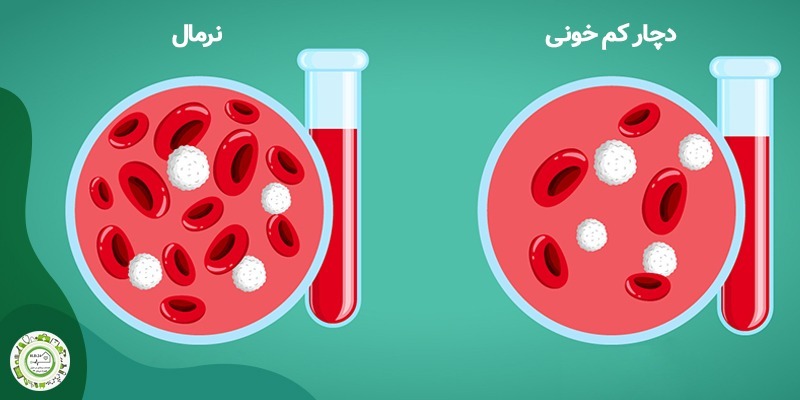 کم خونی