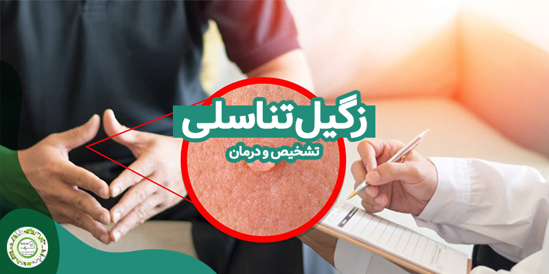 تشخیص و درمان زگیل تناسلی